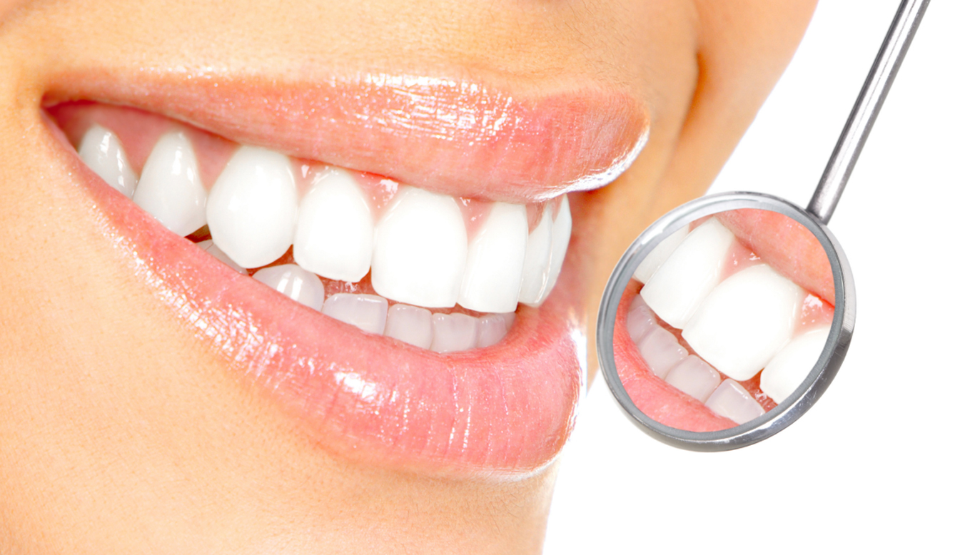 Diş Nasıl Beyazlatılır? Kesin Çözüm Önerileri