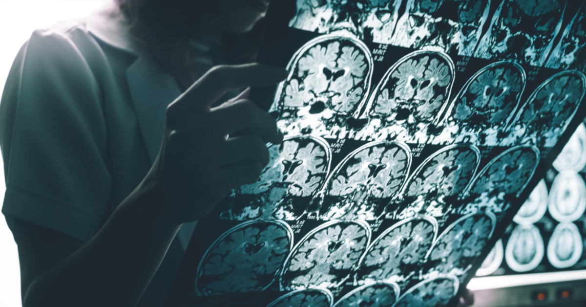 AB, tarihi Alzheimer ilacına ruhsat vermedi: Faydası, riskleri görmezden gelecek kadar değil - Haberler | Sağlık Haberleri