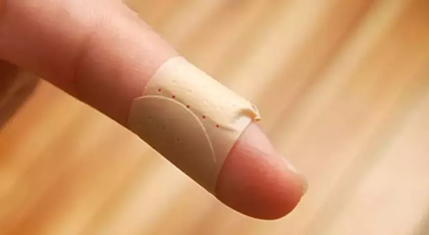 El kanaması nasıl durdurulur? Kesik kanamaları nasıl durdurulu? İşte detaylar