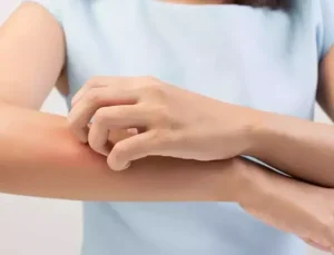 Cilt Kuruluğunuz Böbreklerinizle İlgili Olabilir!