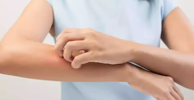 Cilt Kuruluğunuz Böbreklerinizle İlgili Olabilir!
