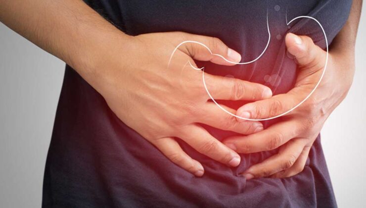 Mide Yanması Neden Olur? Belirtileri, Nedenleri ve Doğal Çözüm Yolları
