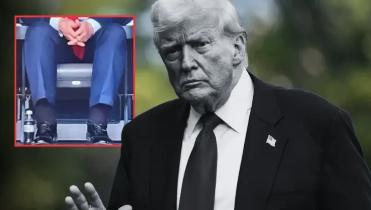 Trump’a ‘Kronik Venöz Yetmezlik’ Teşhisi: Tehlikeli mi?