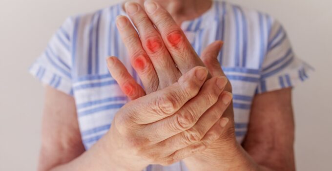 Parmaklar Neden Uyuşur?