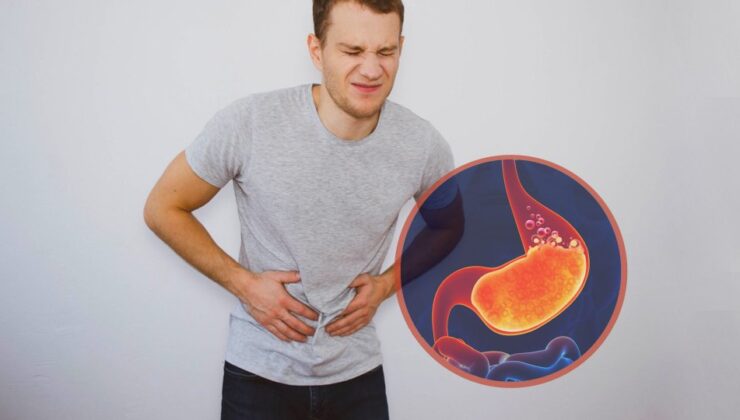 Mide Yanmasına Ne İyi Gelir? 2025 Güncel Çözümler ve Öneriler