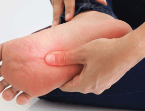 Ayak Uyuşması Neden Olur? 2025 Güncel Sebepler ve Çözüm Yolları